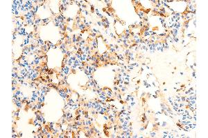 ABIN6267071 at 1/100 staining rat lung tissue sections by IHC-P. (SYK antibody  (pTyr323))