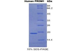 SDS-PAGE (SDS) image for PR Domain Containing 1, with ZNF Domain (PRDM1) (AA 29-149) protein (His tag) (ABIN1525546)