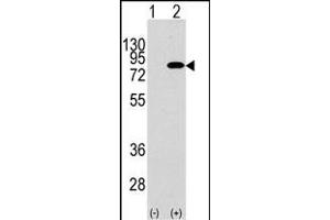 Western blot analysis of PIK3R2 (arrow) using rabbit polyclonal PIK3R2 Antibody  (R). (PIK3R2 antibody  (AA 445-474))