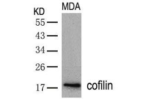 Western blot analysis of extracts from MDA cells using cofilin(Ab-3) Antibody. (Cofilin antibody  (AA 1-5))