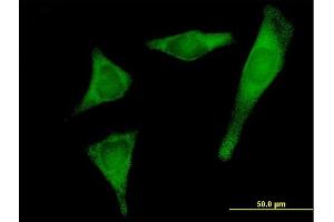 Immunofluorescence of purified MaxPab antibody to PRPSAP2 on HeLa cell. (PRPSAP2 antibody  (AA 1-369))