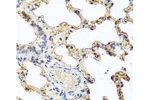 Immunohistochemistry of paraffin-embedded Rat lung using PIP Polyclonal Antibody at dilution of 1:100 (40x lens). (PIP antibody)