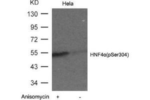 Western blot analysis of extracts from Hela cells untreated or treated with Anisomyclin using HNF4a(Phospho-Ser304) Antibody. (HNF4A antibody  (pSer304))