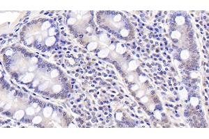 Detection of ASPH in Human Small intestine Tissue using Polyclonal Antibody to Aspartate Beta Hydroxylase (ASPH) (Aspartate beta Hydroxylase antibody  (AA 345-758))