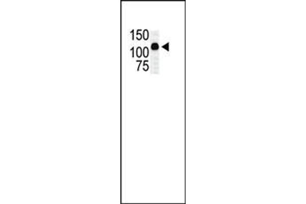 MAP3K10 antibody  (C-Term)