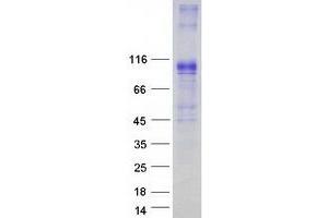 Validation with Western Blot (Band 3/AE1 Protein (Myc-DYKDDDDK Tag))