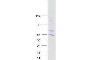 Validation with Western Blot (DHDH Protein (Myc-DYKDDDDK Tag))