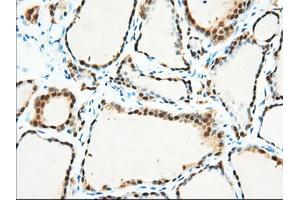 Immunohistochemical staining of paraffin-embedded Human pancreas tissue using anti-BDH2 mouse monoclonal antibody.