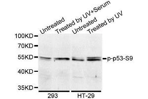 Western blot analysis of extracts of 293 cell lines, using Phospho-TP53-S9 antibody. (p53 antibody  (pSer9))