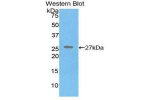 Western Blotting (WB) image for anti-Elastin (ELN) (AA 392-645) antibody (ABIN1174510) (Elastin antibody  (AA 392-645))