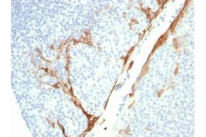 Formalin-fixed, paraffin-embedded human Tonsil stained with CK16 Mouse Recombinant Monoclonal Antibody (rKRT16/1714).