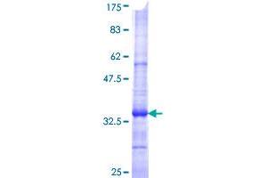 SLC6A3 Protein (AA 161-237) (GST tag)