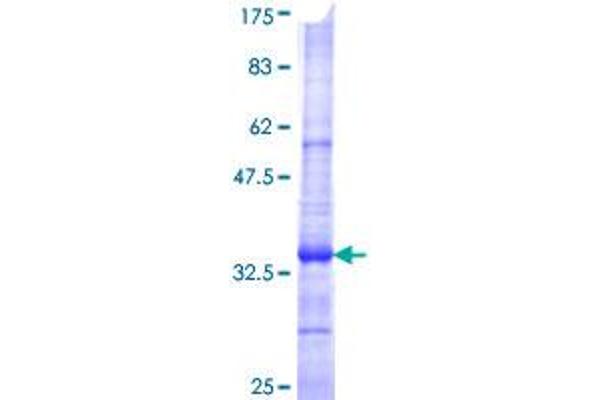 SLC6A3 Protein (AA 161-237) (GST tag)