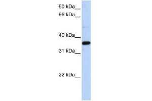 LTB4DH antibody used at 1 ug/ml to detect target protein. (PTGR1 antibody  (N-Term))