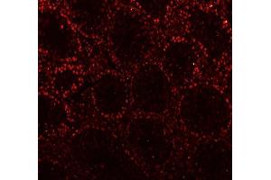 IF analysis of CTBP2 using anti-CTBP2 antibody (ABIN7601326). (CTBP2 antibody  (AA 321-445))