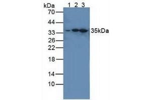 Western blot analysis of (1) Human HeLa cells, (2) Mouse Spleen Tissue and (3) Mouse Brain Tissue.