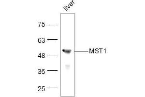 Mouse liver lysates probed with Rabbit Anti-MST1 Polyclonal Antibody, Unconjugated  at 1:500 for 90 min at 37˚C. (MST1 antibody  (AA 385-487))