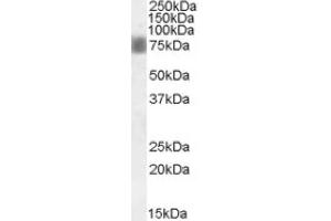 Image no. 1 for anti-NUAK Family, SNF1-Like Kinase, 1 (NUAK1) (Internal Region) antibody (ABIN375083)