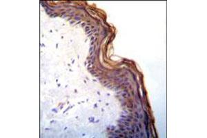 Immunohistochemical staining of formalin fixed and paraffin embedded human skin was performed with KLK7 polyclonal antibody  at 1:10-1:50 dilution followed by indirect peroxidase conjugation with secondary antibody and DAB staining. (Kallikrein 7 antibody  (C-Term))