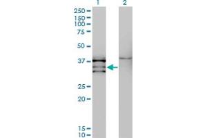 Western Blot analysis of NKX2-5 expression in transfected 293T cell line by NKX2-5 monoclonal antibody (M08), clone 3E3. (NK2 Homeobox 5 antibody  (AA 1-130))