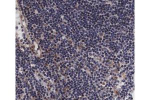 ABIN6267393 at 1/200 staining human lymph node tissue sections by IHC-P. (VAV1 antibody  (pTyr174))