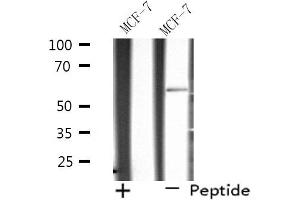 Western blot analysis of extracts from MCF-7 cells using SHC2 antibody.