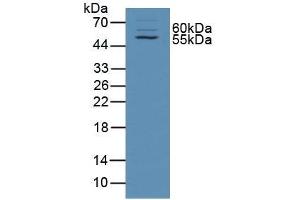 Figure. (alpha Taxilin antibody  (AA 1-234))
