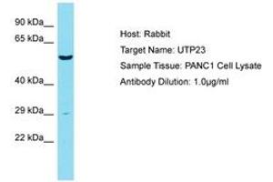 Image no. 1 for anti-UTP23, Small Subunit (SSU) Processome Component, Homolog (UTP23) (AA 151-200) antibody (ABIN6750446) (UTP23 antibody  (AA 151-200))