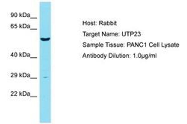 UTP23 antibody  (AA 151-200)