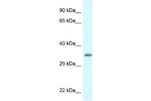 Western Blot showing PDLIM1 antibody used at a concentration of 1 ug/ml against Hela Cell Lysate (PDLIM1 antibody  (C-Term))