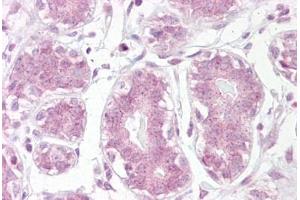 Immunohistochemistry (IHC) image for anti-Nuclear Factor of kappa Light Polypeptide Gene Enhancer in B-Cells Inhibitor, alpha (NFKBIA) (AA 34-48) antibody (ABIN960907)