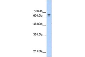 Western Blotting (WB) image for anti-Poly (ADP-Ribose) Polymerase Family, Member 6 (PARP6) antibody (ABIN2460859) (PARP6 antibody)