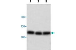 Western blot analysis of HeLa (Lane 1), human fetal heart (Lane 2) and human skeletal muscle (Lane 3) with ADNP polyclonal antibody  at 1:500 dilution. (ADNP antibody)