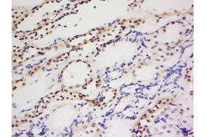 Formalin-fixed and paraffin embedded human kidney labeled with Anti-PIWIL1 Polyclonal Antibody, Unconjugated  at 1:200 followed by conjugation to the secondary antibody and DAB staining.