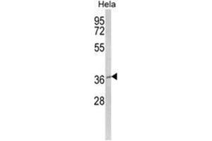 Western blot analysis of MOSC2 Antibody (C-term) in Hela cell line lysates (35ug/lane). (MARC2 antibody  (C-Term))