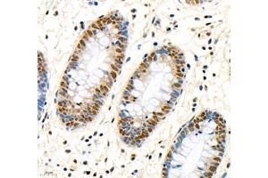 Immunohistochemistry of paraffin embedded human colon using MST1 (ABIN7075561) at dilution of 1: 1000 (400x lens) (STK4 antibody)