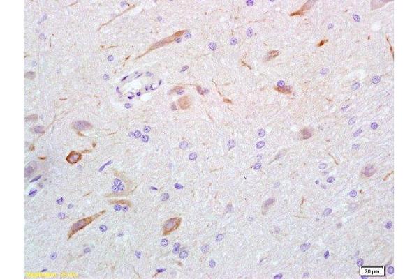 GABA antibody