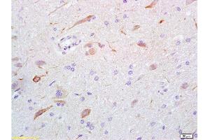 Formalin-fixed and rat brain tissue labeled with Anti-GABA Polyclonal Antibody, Unconjugated  at 1:200 followed by conjugation to the secondary antibody and DAB staining (GABA antibody)