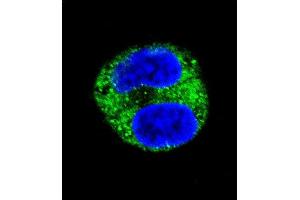 Confocal immunofluorescent analysis of TYR Antibody (Center) (ABIN391521 and ABIN2841481) with HepG2 cell followed by Alexa Fluor 488-conjugated goat anti-rabbit lgG (green). (TYR antibody  (AA 176-205))