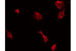 ABIN6269322 staining NIH-3T3 by IF/ICC. (FAK antibody  (Internal Region))