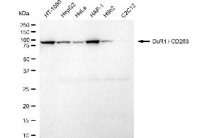 Western blotting analysis using DcR1 / CD263 antibody (ABIN7800672).