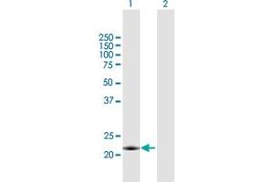 Western Blot analysis of MID1IP1 expression in transfected 293T cell line by MID1IP1 MaxPab polyclonal antibody. (m1ip1 antibody  (AA 1-183))