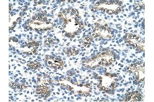 Cytokeratin 13 antibody was used for immunohistochemistry at a concentration of 4-8 ug/ml to stain Alveolar cells (arrows) in Human Lung. (Cytokeratin 13 antibody  (C-Term))