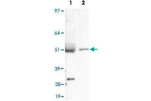 Detection of LIPF in liver lysate using LIPF polyclonal antibody . (LIPF antibody  (AA 1-100))
