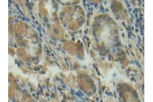 Detection of MMP13 in Human Stomach Tissue using Polyclonal Antibody to Matrix Metalloproteinase 13 (MMP13)