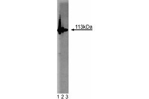 Western blot analysis of PARP on Jurkat cell lysate.