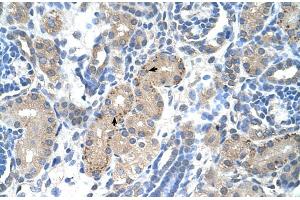 Human kidney (FOXR2 antibody  (N-Term))