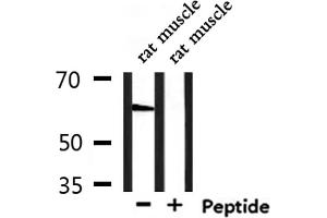 Western blot analysis of extracts from rat muscle, using GPR148 Antibody. (GPR148 antibody)