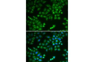 Immunofluorescence analysis of MCF-7 cells using RPL5 antibody (ABIN5971027). (RPL5 antibody)