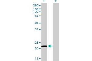 Western Blotting (WB) image for anti-Peroxiredoxin 2 (PRDX2) (AA 1-199) antibody (ABIN598967) (Peroxiredoxin 2 antibody  (AA 1-199))